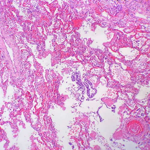 lung section